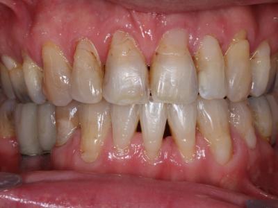 2. Implantologie et orthodontie