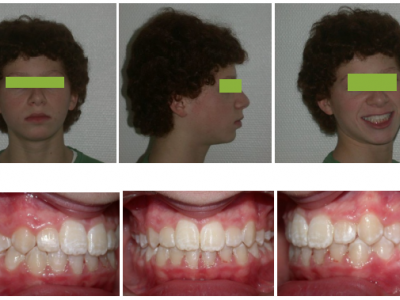Fig. 23 Photographies faciales et intraorales après traitement.