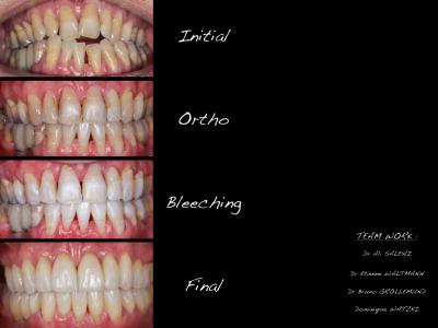 Comparatif