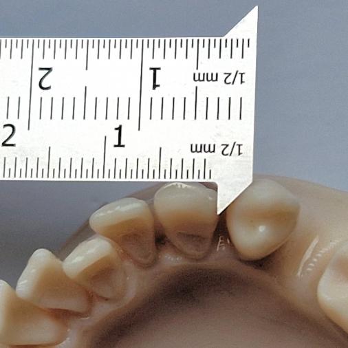 Mesure de diamètre MoD