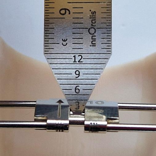 Mesure de vérins