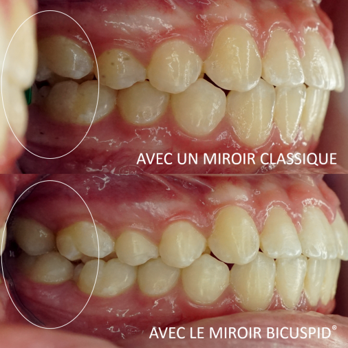 Miroir photographique dentaire - Bicuspid petit format